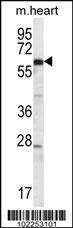 Anti-FOXO4 Rabbit Polyclonal Antibody