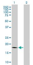 Anti-PTP4A1 Mouse Polyclonal Antibody