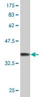 Anti-STAT5A Mouse Monoclonal Antibody [clone: 1B12]