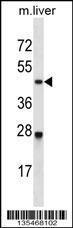 Anti-CDK2 Rabbit Polyclonal Antibody (HRP (Horseradish Peroxidase))