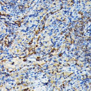 Immunohistochemistry analysis of paraffin-embedded mouse spleen using Anti-PRC1 Antibody (A10047) at a dilution of 1:100 (40X lens). Perform high pressure antigen retrieval with 10 mM citrate buffer pH 6.0 before commencing with IHC staining protocol