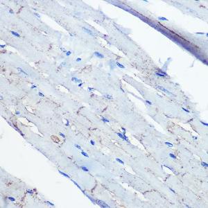 Immunohistochemistry analysis of paraffin-embedded rat heart using Anti-Ephrin B2 Antibody [ARC0576] (A80671) at a dilution of 1:100 (40x lens). Perform microwave antigen retrieval with 10 mM PBS buffer pH 7.2 before commencing with IHC staining protocol