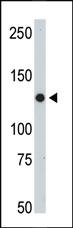 Anti-JAK2 Rabbit Polyclonal Antibody [clone: 6E3F8]