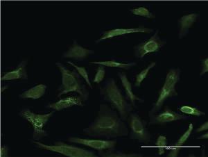 Anti-LGALS3 Mouse Monoclonal Antibody [clone: 3G8]