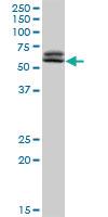 Anti-TAF6 Rabbit Polyclonal Antibody