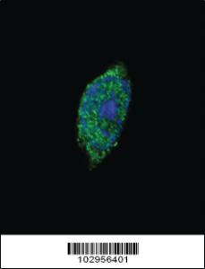 Anti-JAK2 Rabbit Polyclonal Antibody [clone: 6E3F8]