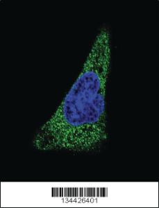 Anti-SLC11A2 Rabbit Polyclonal Antibody