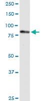 Anti-PNPT1 Rabbit Polyclonal Antibody