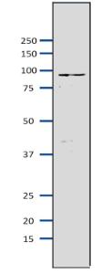 Anti-MCM7 Antibody