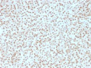 Anti-AKT1 Mouse Monoclonal Antibody [clone: AKT1/2491]