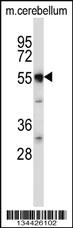 Anti-SLC11A2 Rabbit Polyclonal Antibody