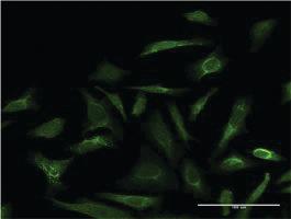 Anti-LGALS3 Mouse Monoclonal Antibody [clone: 3G8]