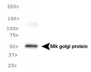 Anti-FTCD Mouse Monoclonal Antibody [clone: 58K-9]