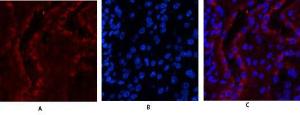 Anti-Estrogen Receptor-beta antibody