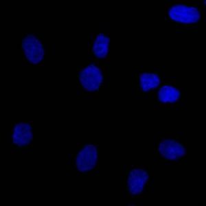 Negative Control: Immunofluorescent analysis of SK-OV-3 cells using Mouse IgG1 (AF488) - Isotype Control (Green) DAPI was used to stain the cell nuclei (Blue)