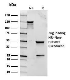 SDS-PAGE analysis of Anti-TLR2 Antibody [rTLR2/221] under non-reduced and reduced conditions; showing intact IgG and intact heavy and light chains, respectively. SDS-PAGE analysis confirms the integrity and purity of the antibody