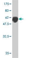 Anti-TSSK3 Mouse Monoclonal Antibody [clone: 6B2]