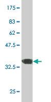 Anti-ERN1 Mouse Monoclonal Antibody [clone: 4D12]