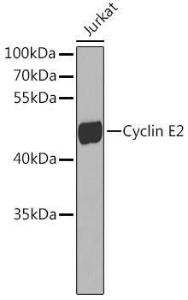 Anti-Cyclin E2 antibody