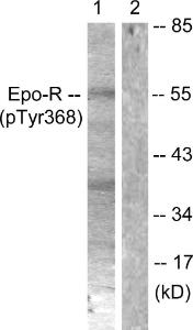 Western blot analysis of lysates from K562 cells using Anti-Epo-R (phospho Tyr368) Antibody. The right hand lane represents a negative control, where the antibody is blocked by the immunising peptide.