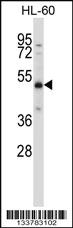 Anti-RARA Rabbit Polyclonal Antibody