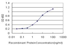 Anti-CDG1H Mouse Monoclonal Antibody [clone: 2E10]