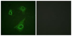 Immunofluorescence analysis of HepG2 cells using Anti-Epo-R (phospho Tyr368) Antibody. The right hand panel represents a negative control, where the antibody was pre-incubated with the immunising peptide.