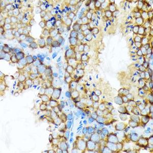 Anti-STIP1/STI1 Rabbit Monoclonal Antibody [Clone: ARC1805]