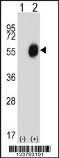 Anti-RARA Rabbit Polyclonal Antibody