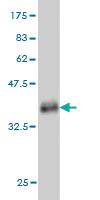 Anti-FAM215A Mouse Monoclonal Antibody [clone: 6D11]