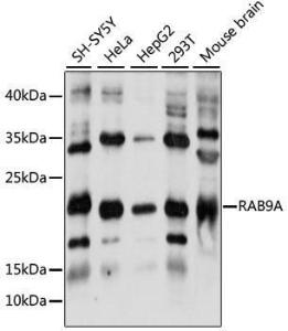 Anti-Rab9 antibody