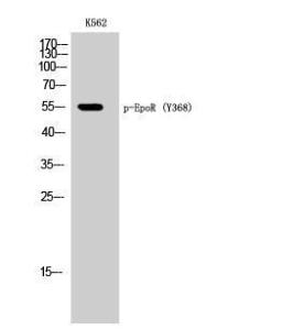 Western blot analysis of K562 cells using Anti-Epo-R (phospho Tyr368) Antibody