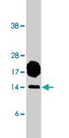 Anti-CSAG2 Rabbit Polyclonal Antibody