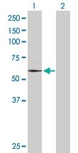 Anti-TAF6 Rabbit Polyclonal Antibody