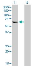 Anti-VPS72 Rabbit Polyclonal Antibody