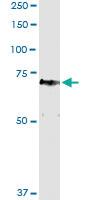 Anti-HBS1L Polyclonal Antibody Pair