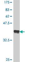 Anti-DLG5 Mouse Polyclonal Antibody