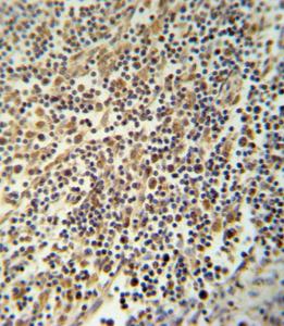 Anti-NLRP3 Rabbit Polyclonal Antibody (Biotin)