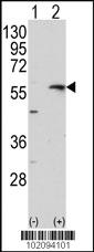 Anti-MMP13 Rabbit Polyclonal Antibody