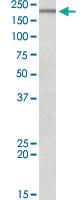 Anti-DENND4C Goat Polyclonal Antibody