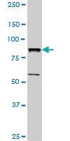 Anti-BBS7 Rabbit Polyclonal Antibody