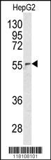 Anti-NUP62 Rabbit Polyclonal Antibody