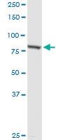 Anti-PNPT1 Rabbit Polyclonal Antibody