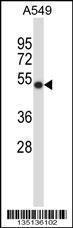 Anti-HOXC10 Rabbit Polyclonal Antibody (FITC (Fluorescein Isothiocyanate))