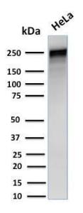 Western blot analysis of human HeLa cell lysate using Anti-alpha 1 Spectrin Antibody [SPTA1/1832]