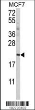 Anti-ATG12 Rabbit Polyclonal Antibody