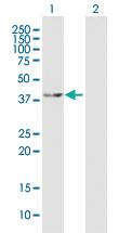 Anti-MAP2K4 Mouse Polyclonal Antibody