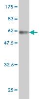 Anti-TSSK3 Mouse Monoclonal Antibody [clone: 3D7]