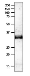 Anti-Ssb2 Rabbit Polyclonal Antibody