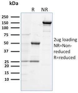 SDS-PAGE analysis of Anti-TLR4 Antibody [TLR4/230] under non-reduced and reduced conditions; showing intact IgG and intact heavy and light chains, respectively. SDS-PAGE analysis confirms the integrity and purity of the antibody